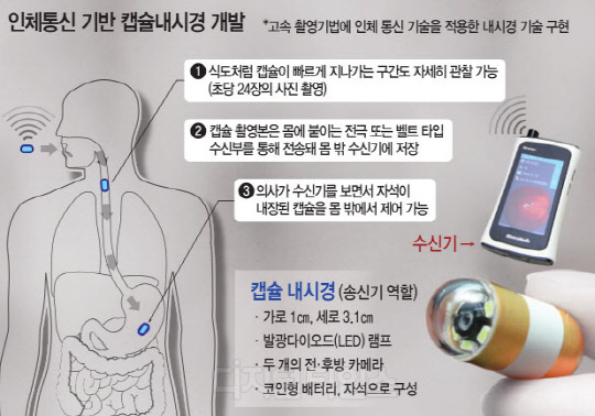 초당 24장 찍는 `캡슐내시경`, 식도·위 정밀진단 가능해졌다 - 디지털타임스
